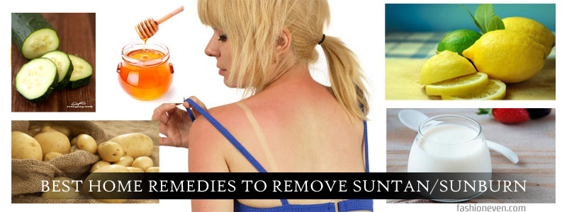 Home remedies to-remove-sunburn-or-suntan
